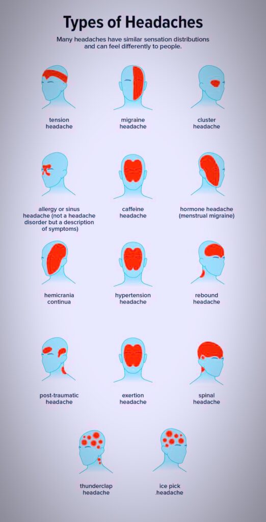 Types of Headaches in Human
